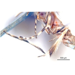 /filer/webapps/moths_gc/media/images/X/xerocarpa_Epicephala_PTM_legs_ANIC.jpg