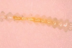 Macrosaccus morrisella