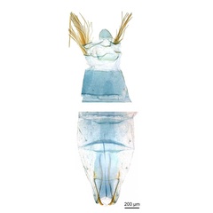 /filer/webapps/moths_gc/media/images/P/pyrochroma_Cuphodes_LT_GM_abdomen_ANIC.jpg
