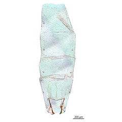 /filer/webapps/moths_gc/media/images/L/litchiella_Conopomorpha_abdomen_De-Prins-etal_2025_34.jpg