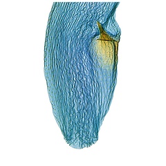 /filer/webapps/moths_gc/media/images/C/crotonella_Diphtheroptila_PT10_GF_bursa_ANIC.jpg