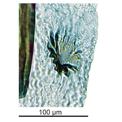 /filer/webapps/moths_gc/media/images/D/dunkensis_Epicephala_HT_GF_signum_ANIC.jpg