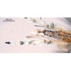 /filer/webapps/moths_gc/media/images/N/niphadias_Cuphodes_abdomen2_NULT023064_ANIC.jpg