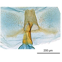 /filer/webapps/moths_gc/media/images/B/braidella_Parectopa_HT_GF_antrum_ANIC.jpg