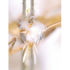 /filer/webapps/moths_gc/media/images/E/eugonia_Epicephala_HT_head1_ANIC.jpg