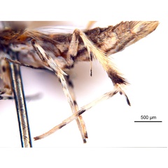 /filer/webapps/moths_gc/media/images/P/philippa_Epicephala_PT8_legs_ANIC.jpg