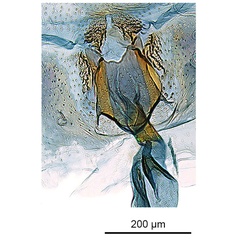 /filer/webapps/moths_gc/media/images/A/acaciella_Parectopa_HT_GF_antrum_ANIC.jpg
