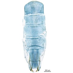 /filer/webapps/moths_gc/media/images/P/pyrochroma_Cuphodes_GF_abdomen_ANIC.jpg