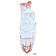 /filer/webapps/moths_gc/media/images/O/oceanica_Conopomorpha_abdomen_DePrins-etal_2025_34.jpg