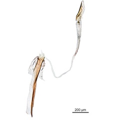 /filer/webapps/moths_gc/media/images/C/cyanospila_Conopomorpha_PLT_GM_aedeagus.jpg
