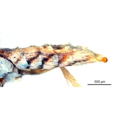 /filer/webapps/moths_gc/media/images/B/breyniphaga_Epicephala_HT_abdomen_ANIC.jpg
