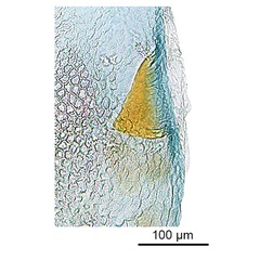 /filer/webapps/moths_gc/media/images/P/philippa_Epicephala_HT_GF_signum_ANIC.jpg