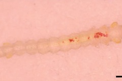Macrosaccus morrisella