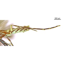 /filer/webapps/moths_gc/media/images/C/cairna_Diphtheroptila_HT_legs_ANIC.jpg
