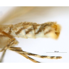 /filer/webapps/moths_gc/media/images/G/glochidiella_Diphtheroptila_PT_abdomen_ANIC.jpg