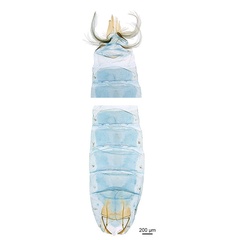 /filer/webapps/moths_gc/media/images/B/breyniphaga_Epicephala_PT2_GM_abdomen_ANIC.jpg
