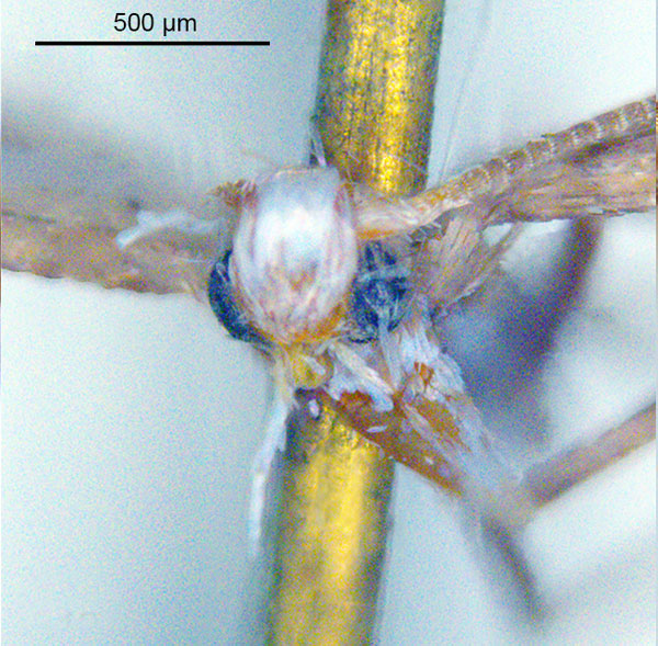 /filer/webapps/moths_gc/media/images/A/albistriatella_Epicephala_LT_head_ANIC.jpg
