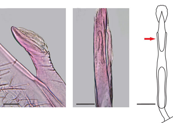 /filer/webapps/moths_gc/media/images/A/ambrosiavora_Atacamaptilia_aedeagus_Espinoza-Donoso-etal_2022_408.jpg