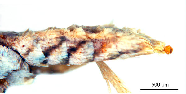 /filer/webapps/moths_gc/media/images/B/breyniphaga_Epicephala_HT_abdomen_ANIC.jpg