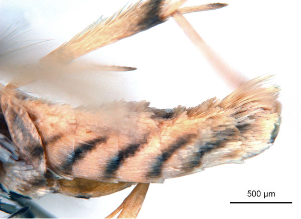 /filer/webapps/moths_gc/media/images/B/breyniphaga_Epicephala_PT2_abdomen_ANIC.jpg