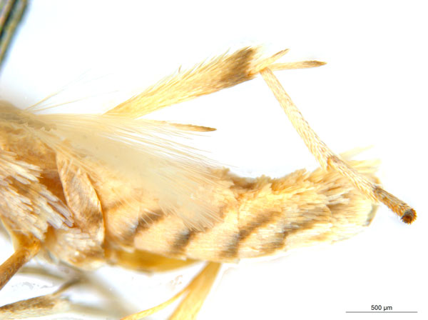 /filer/webapps/moths_gc/media/images/B/breyniphaga_Epicephala_PT2_legs_ANIC.jpg