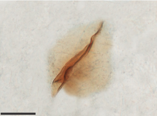 /filer/webapps/moths_gc/media/images/C/chilensis_Leurocephala_GF_signum1_Pereira-et-al_2017.jpg