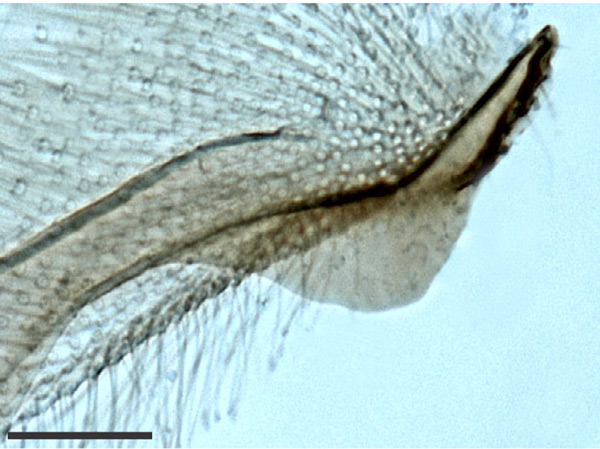 /filer/webapps/moths_gc/media/images/C/chilensis_Leurocephala_GM_valva_Pereira-et-al_2017.jpg