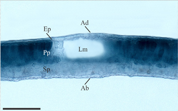 /filer/webapps/moths_gc/media/images/C/chilensis_Leurocephala_mine_early-tissue-feeding_Pereira-et-al_2017.jpg