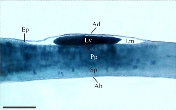 /filer/webapps/moths_gc/media/images/C/chilensis_Leurocephala_mine_sap-feeding_Pereira-et-al_2017.jpg