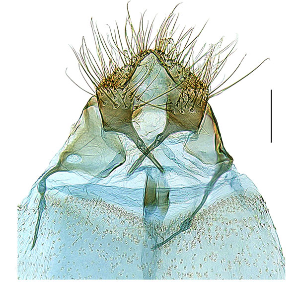 /filer/webapps/moths_gc/media/images/C/cingulata_Gibbovalva_PT_papillae_Sruoga-et-De-Prins-2023_101.jpg