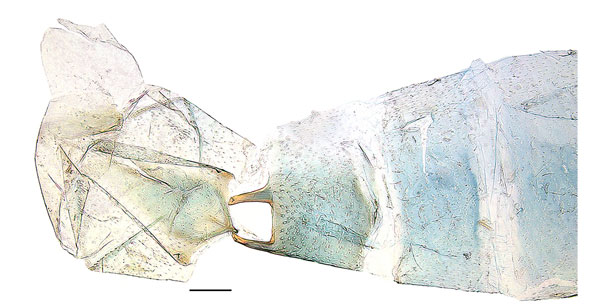 /filer/webapps/moths_gc/media/images/C/columellina_Dialectica_abdomen_Sruoga-et-DePrins_2023_91.jpg