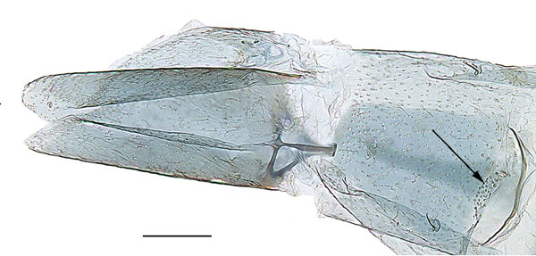 /filer/webapps/moths_gc/media/images/C/convexa_Cryptolectica_abdomen_Sruoga-et-De-Prins_2023_82.jpg