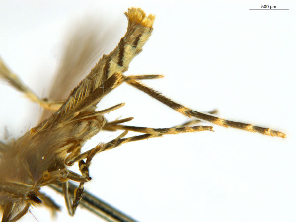 /filer/webapps/moths_gc/media/images/C/crotonella_Diphtheroptila_PT10_legs_ANIC.jpg