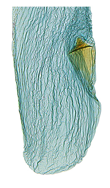 /filer/webapps/moths_gc/media/images/C/crotonella_Diphtheroptila_PT12_GF_bursa_ANIC.jpg