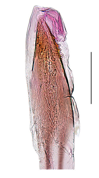 /filer/webapps/moths_gc/media/images/C/cuneata_Spulerina_aedeagus_Sruoga-et-De-Prins_2023_103.jpg