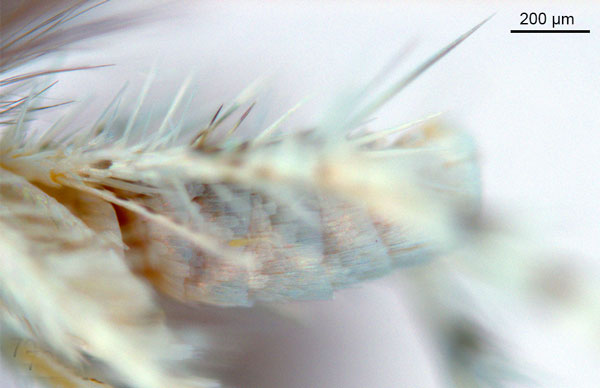 /filer/webapps/moths_gc/media/images/D/drypette_Cuphodes_HT_abdomen_ANIC.jpg