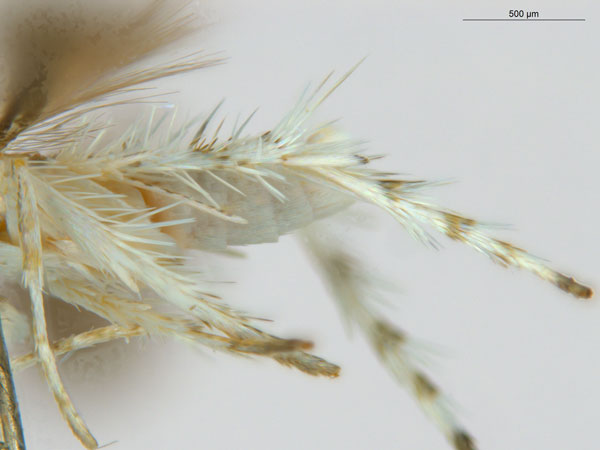 /filer/webapps/moths_gc/media/images/D/drypette_Cuphodes_HT_legs_ANIC.jpg