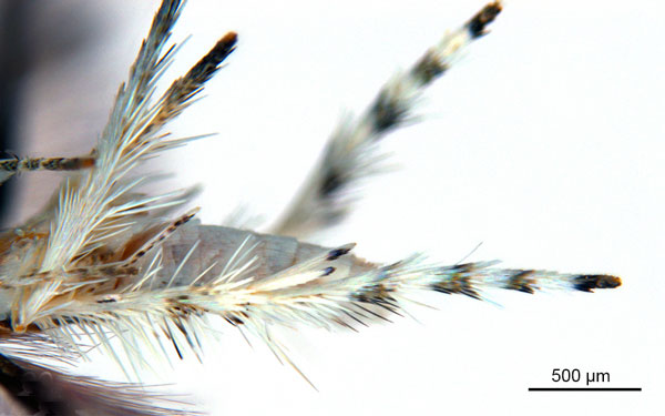 /filer/webapps/moths_gc/media/images/D/drypette_Cuphodes_PT_legs1_ANIC.jpg