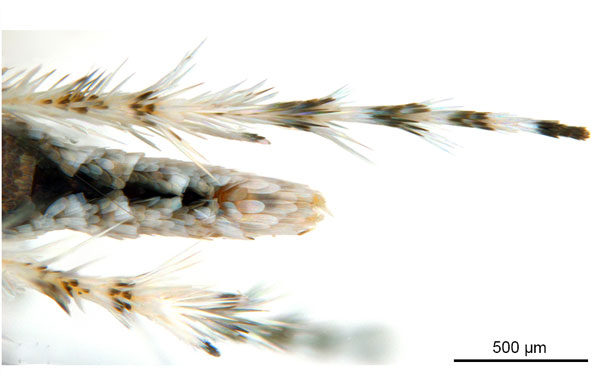 /filer/webapps/moths_gc/media/images/D/drypette_Cuphodes_PT_legs2_ANIC.jpg