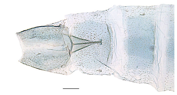 /filer/webapps/moths_gc/media/images/E/euryphanta_Cryptolectica_abdomen_Sruoga-et-De-Prins_2023_86.jpg