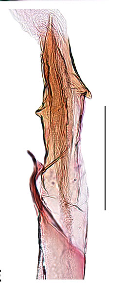 /filer/webapps/moths_gc/media/images/E/euryphanta_Cryptolectica_aedeagus_Sruoga-et-De-Prins_2023_86.jpg