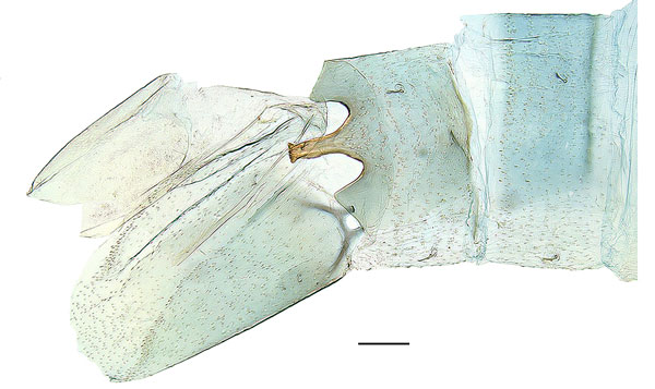 /filer/webapps/moths_gc/media/images/F/falcata_Dialectica_abdomen_Sruoga-et-De-Prins_2023_91.jpg