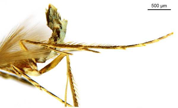 /filer/webapps/moths_gc/media/images/G/glochidia_Diphtheroptila_HT_legs_ANIC.jpg