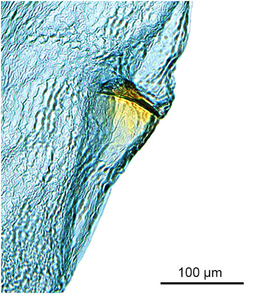 /filer/webapps/moths_gc/media/images/G/glochidia_Diphtheroptila_PT1_GF_signum_ANIC.jpg