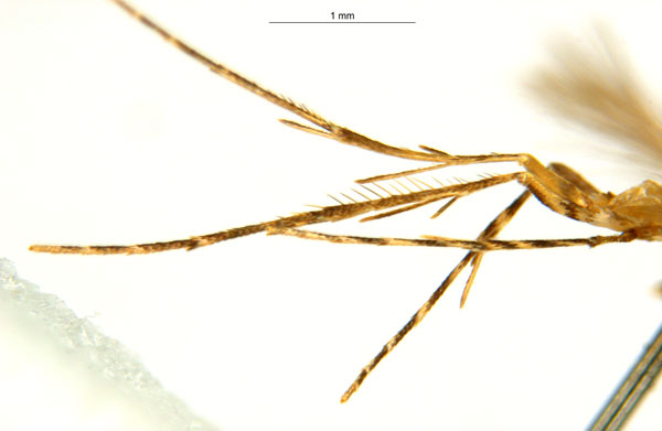 /filer/webapps/moths_gc/media/images/G/glochidia_Diphtheroptila_PT2_legs_ANIC.jpg