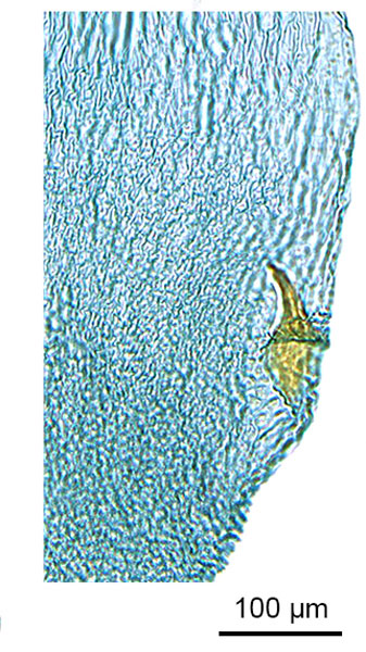 /filer/webapps/moths_gc/media/images/G/glochidiella_Diphtheroptila_HT_GF_signum_ANIC.jpg