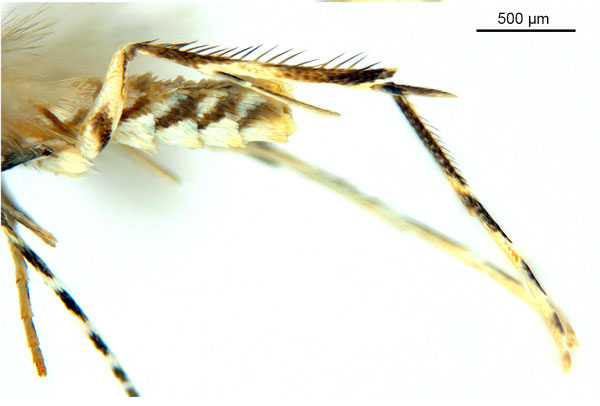 /filer/webapps/moths_gc/media/images/G/glochidiella_Diphtheroptila_HT_legs_ANIC.jpg