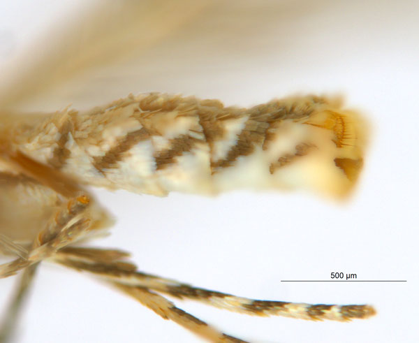 /filer/webapps/moths_gc/media/images/G/glochidiella_Diphtheroptila_PT_abdomen_ANIC.jpg