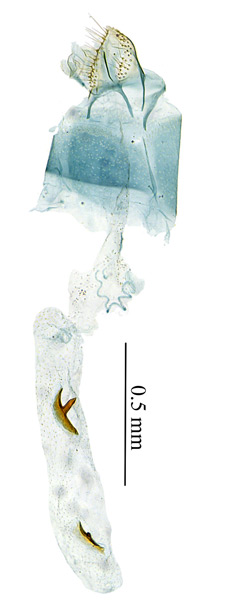 /filer/webapps/moths_gc/media/images/P/podocarpa_Phyllocnistis_GF_PT_Liu-et-al_2018b_562_SDNU.jpg