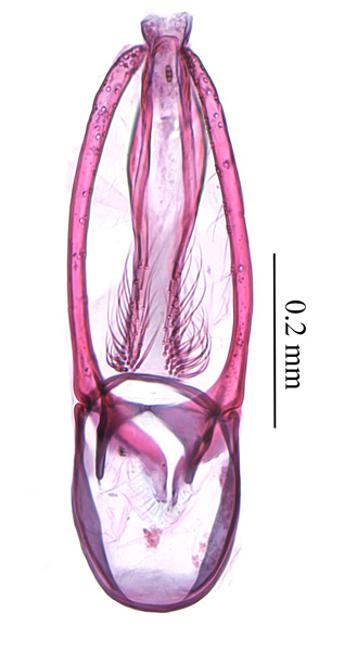 /filer/webapps/moths_gc/media/images/P/podocarpa_Phyllocnistis_GM_PT_Liu-et-al_2018b_562_SDNU.jpg